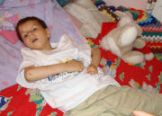 Severe disability
